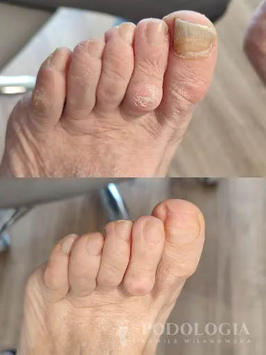 PODOLOGIA Kamila Wilanowska